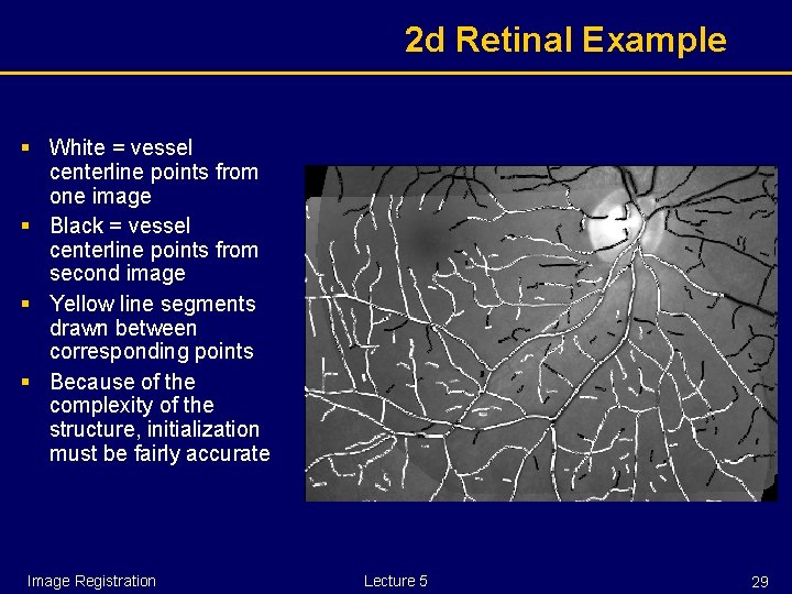 2 d Retinal Example § White = vessel centerline points from one image §