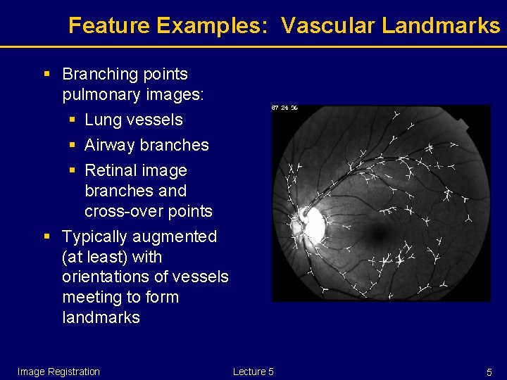 Feature Examples: Vascular Landmarks § Branching points pulmonary images: § Lung vessels § Airway