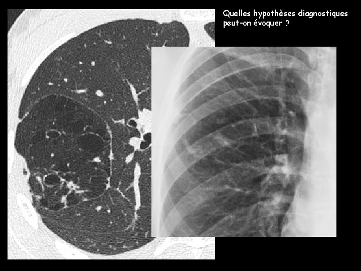 Quelles hypothèses diagnostiques peut-on évoquer ? 