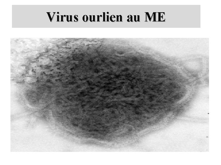 Virus ourlien au ME 
