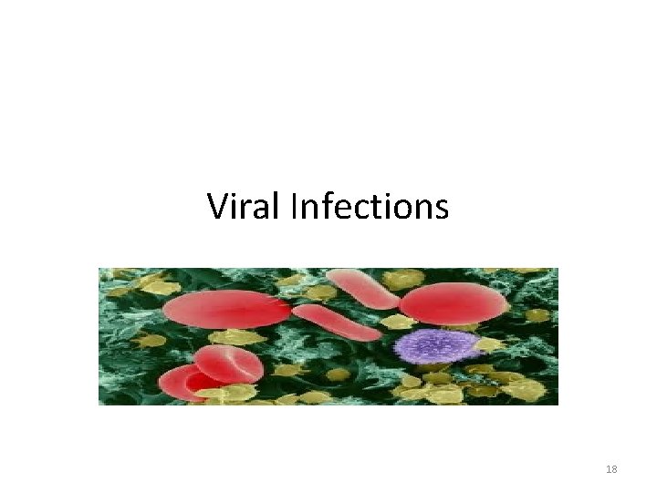 Viral Infections 18 