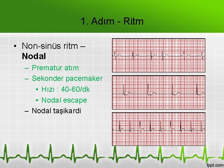 1. Adım - Ritm • Non-sinüs ritm – Nodal – Prematur atım – Sekonder