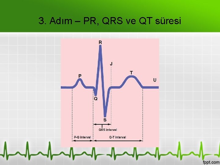 3. Adım – PR, QRS ve QT süresi 