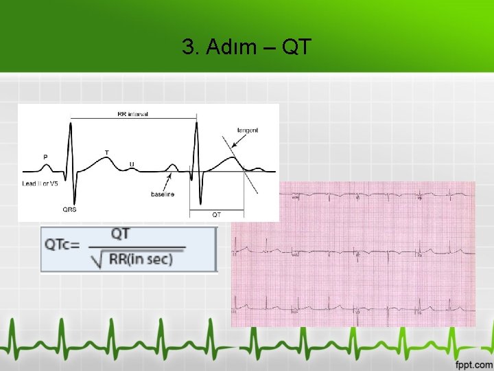 3. Adım – QT 