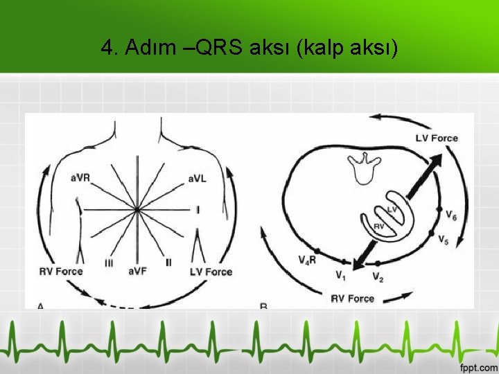 4. Adım –QRS aksı (kalp aksı) 