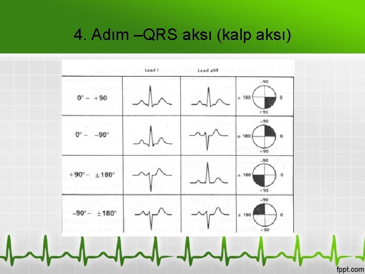 4. Adım –QRS aksı (kalp aksı) 