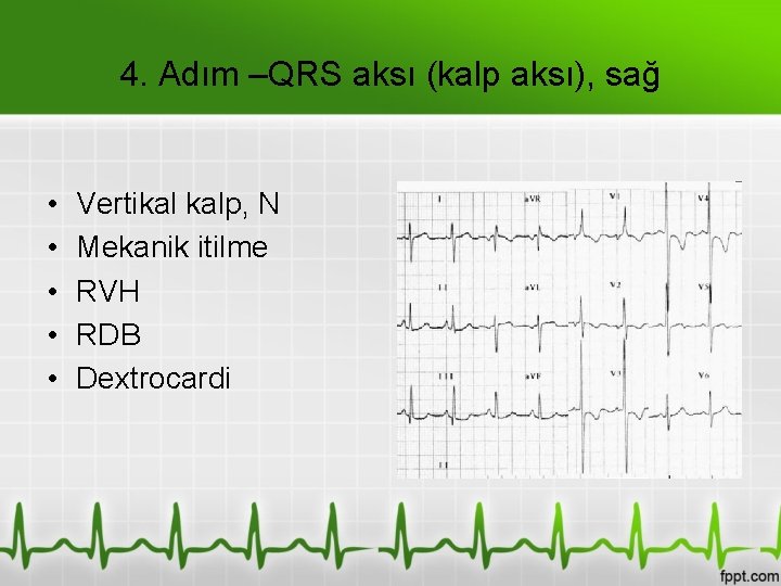 4. Adım –QRS aksı (kalp aksı), sağ • • • Vertikal kalp, N Mekanik