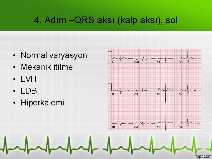 4. Adım –QRS aksı (kalp aksı), sol • • • Normal varyasyon Mekanik itilme