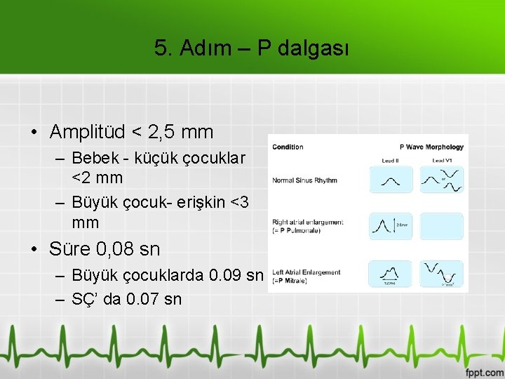 5. Adım – P dalgası • Amplitüd < 2, 5 mm – Bebek -