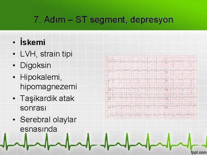 7. Adım – ST segment, depresyon • • İskemi LVH, strain tipi Digoksin Hipokalemi,