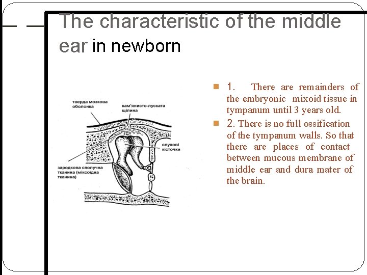 The characteristic of the middle ear in newborn 1. There are remainders of the The characteristic of the middle ear in newborn 1. There are remainders of the