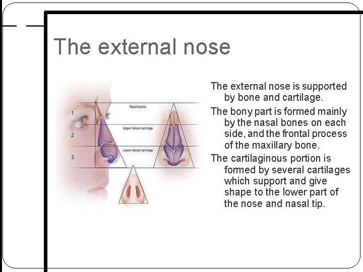 The external nose is supported by bone and cartilage. The bony part is formed The external nose is supported by bone and cartilage. The bony part is formed