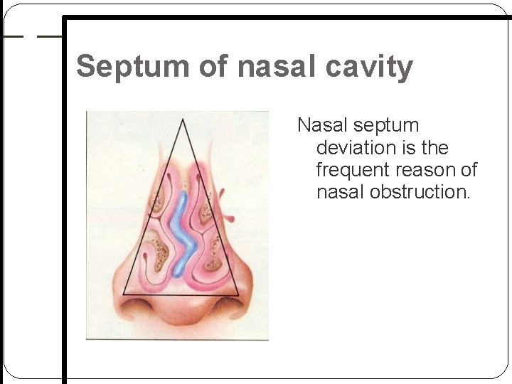 Septum of nasal cavity Nasal septum deviation is the frequent reason of nasal obstruction. Septum of nasal cavity Nasal septum deviation is the frequent reason of nasal obstruction.