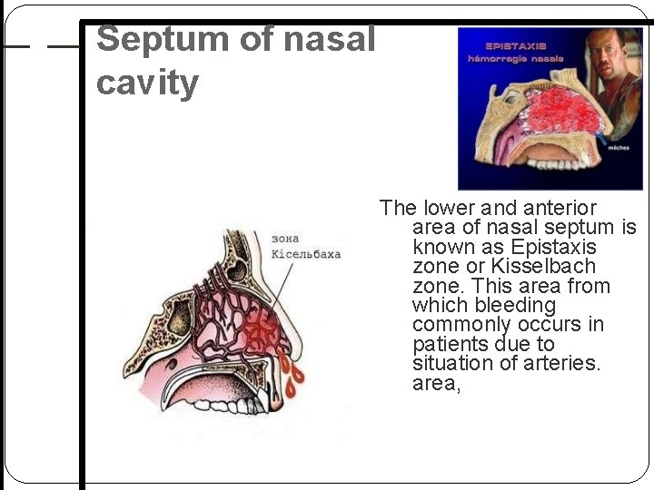 Septum of nasal cavity The lower and anterior area of nasal septum is known Septum of nasal cavity The lower and anterior area of nasal septum is known