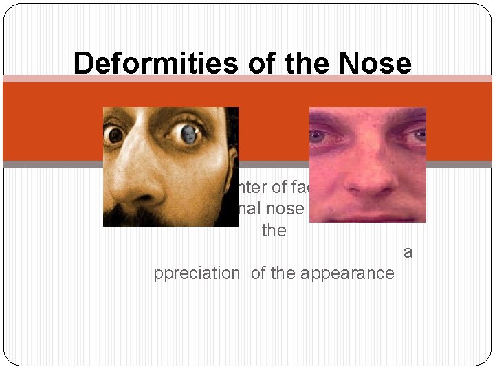 Deformities of the Nose is the center of face. The form of the external Deformities of the Nose is the center of face. The form of the external