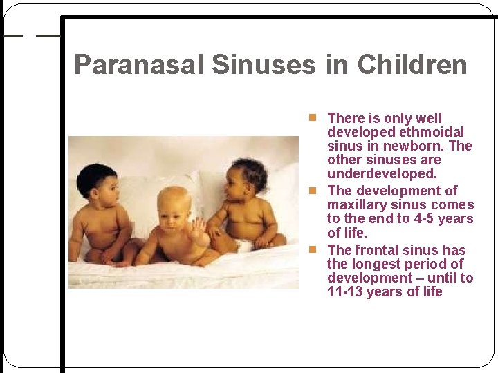 Paranasal Sinuses in Children There is only well developed ethmoidal sinus in newborn. The Paranasal Sinuses in Children There is only well developed ethmoidal sinus in newborn. The
