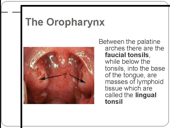 The Oropharynx Between the palatine arches there are the faucial tonsils, while below the The Oropharynx Between the palatine arches there are the faucial tonsils, while below the