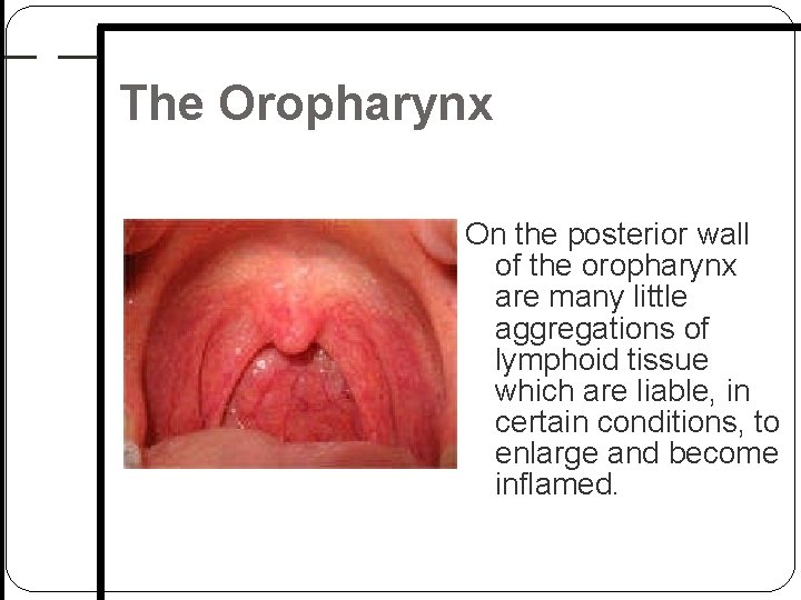 The Oropharynx On the posterior wall of the oropharynx are many little aggregations of The Oropharynx On the posterior wall of the oropharynx are many little aggregations of