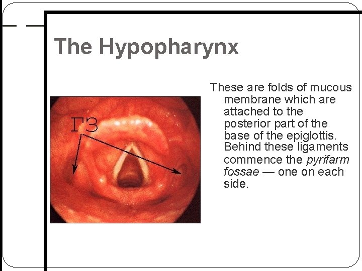 The Hypopharynx These are folds of mucous membrane which are attached to the posterior The Hypopharynx These are folds of mucous membrane which are attached to the posterior