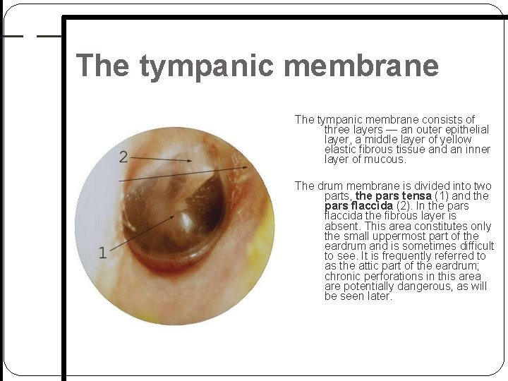 The tympanic membrane consists of three layers — an outer epithelial layer, a middle The tympanic membrane consists of three layers — an outer epithelial layer, a middle