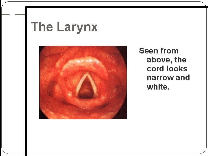 The Larynx Seen from above, the cord looks narrow and white. The Larynx Seen from above, the cord looks narrow and white.