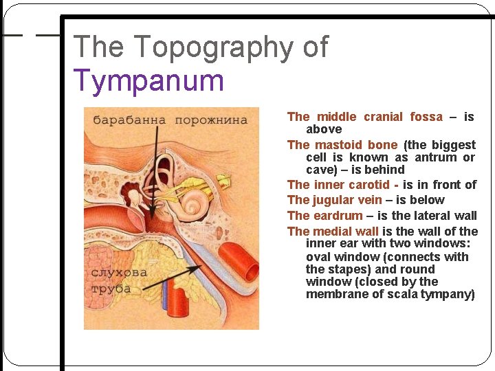 The Topography of Tympanum The middle cranial fossa – is above The mastoid bone The Topography of Tympanum The middle cranial fossa – is above The mastoid bone