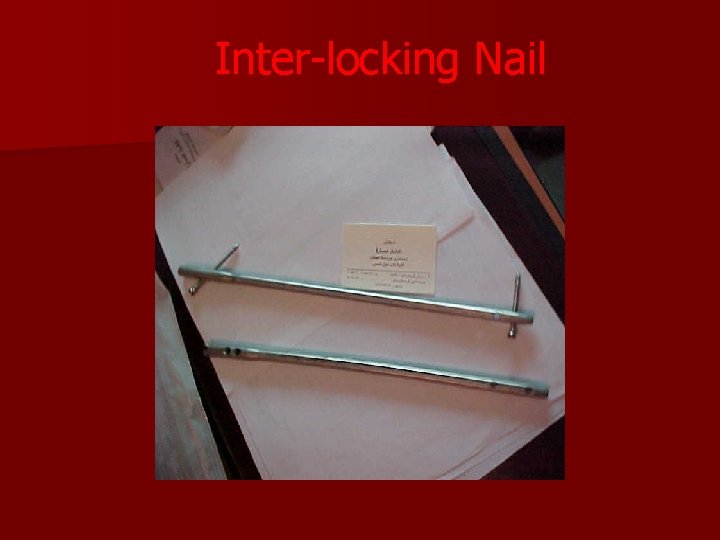 Inter-locking Nail 