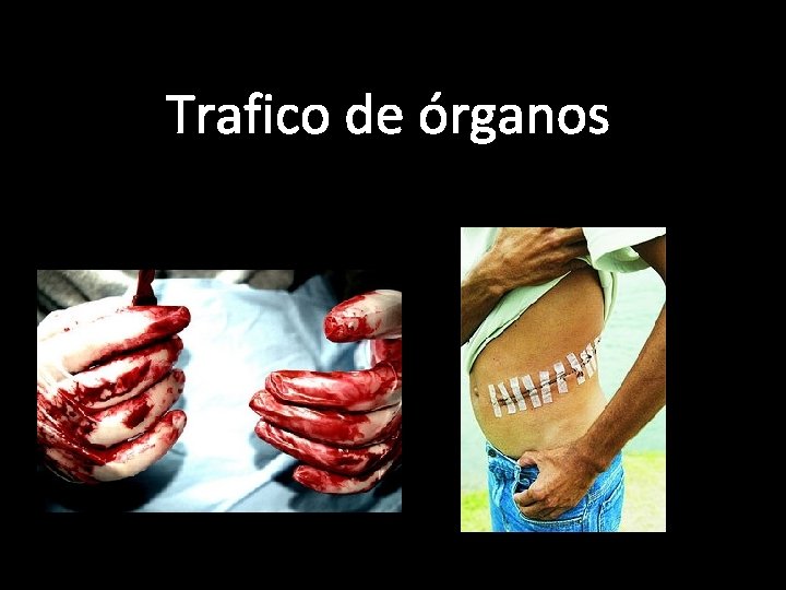 Trafico de órganos 