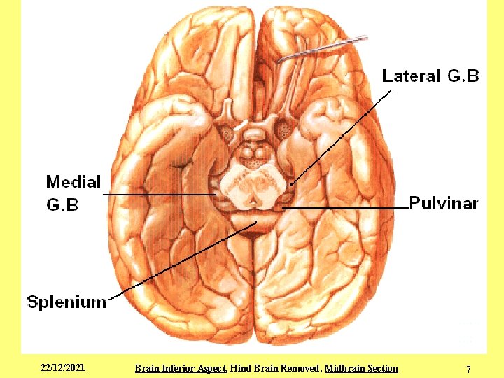 22/12/2021 Brain Inferior Aspect, Hind Brain Removed, Midbrain Section 7 