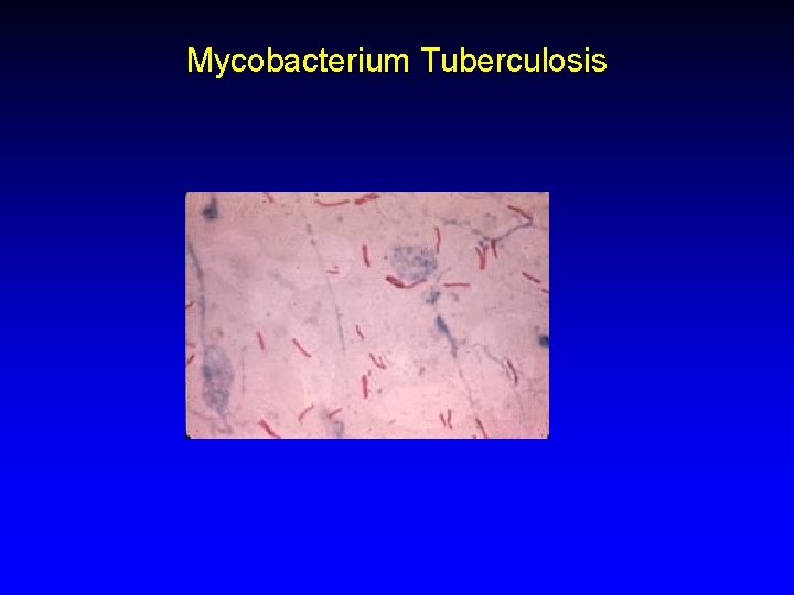 Mycobacterium Tuberculosis 