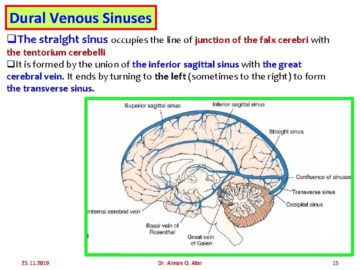 Dural Venous Sinuses q. The straight sinus occupies the line of junction of the