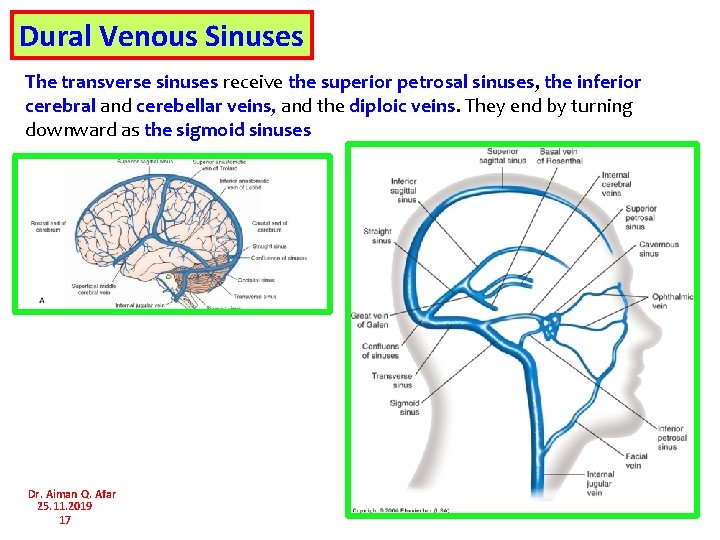 Dural Venous Sinuses The transverse sinuses receive the superior petrosal sinuses, the inferior cerebral