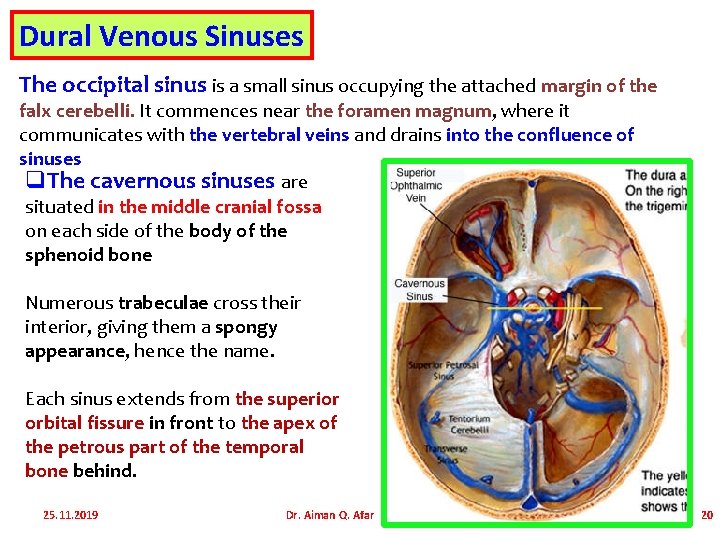 Dural Venous Sinuses The occipital sinus is a small sinus occupying the attached margin