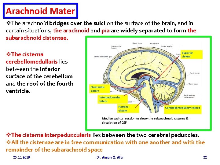 Arachnoid Mater v. The arachnoid bridges over the sulci on the surface of the