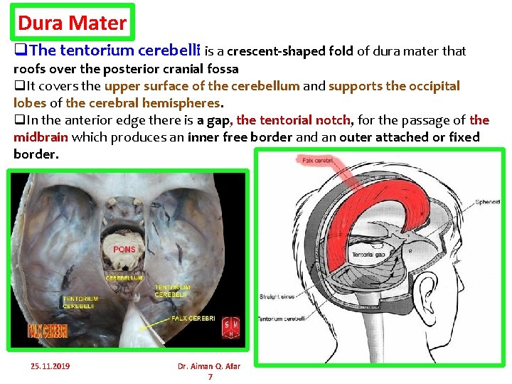 Dura Mater q. The tentorium cerebelli is a crescent-shaped fold of dura mater that