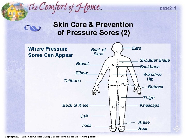page 211 Skin Care & Prevention of Pressure Sores (2) Where Pressure Sores Can