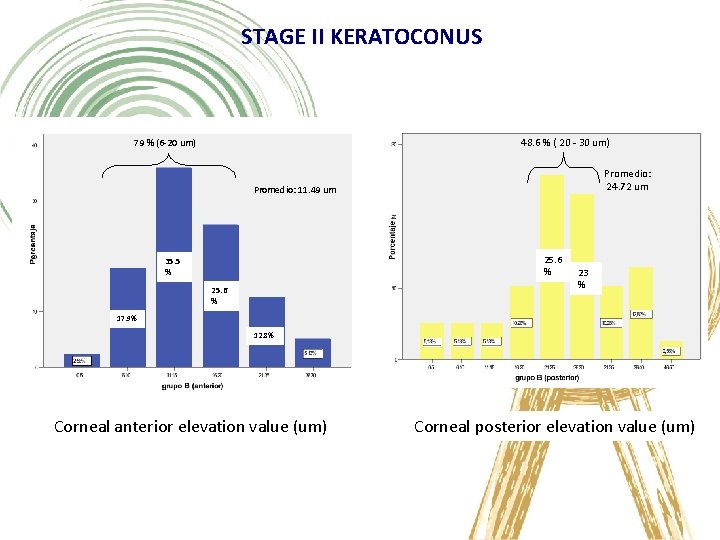 STAGE II KERATOCONUS 48. 6 % ( 20 - 30 um) 79 % (6