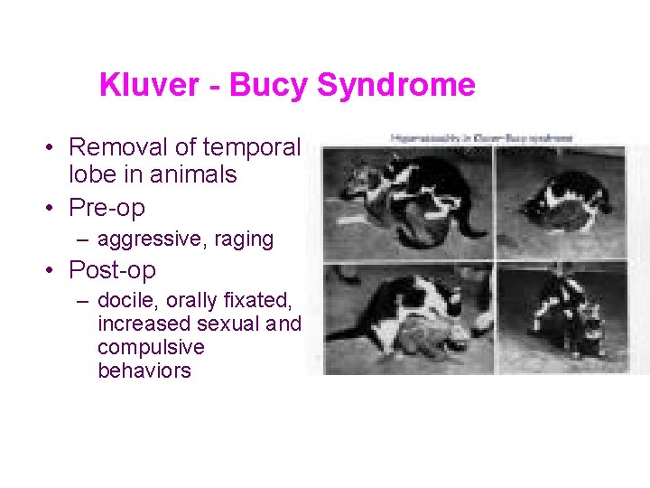 Kluver - Bucy Syndrome • Removal of temporal lobe in animals • Pre-op –