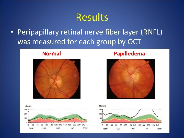 Results • Peripapillary retinal nerve fiber layer (RNFL) was measured for each group by