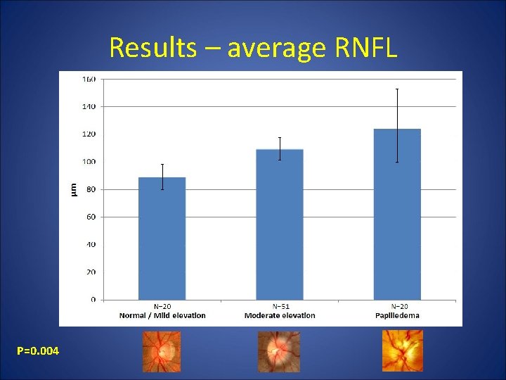 Results – average RNFL P=0. 004 
