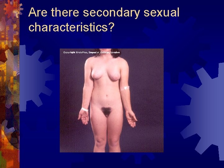 Are there secondary sexual characteristics? 