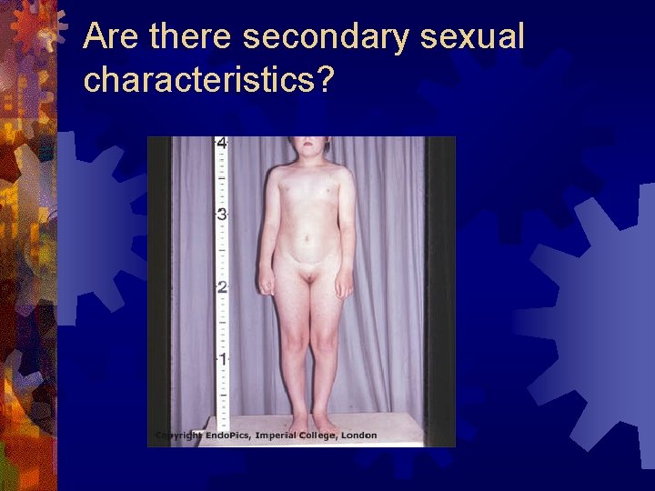 Are there secondary sexual characteristics? 