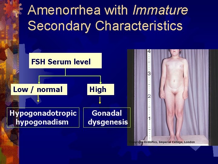 Amenorrhea with Immature Secondary Characteristics FSH Serum level Low / normal Hypogonadotropic hypogonadism High