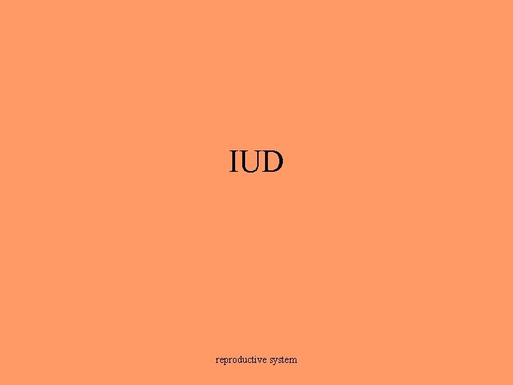 IUD reproductive system 