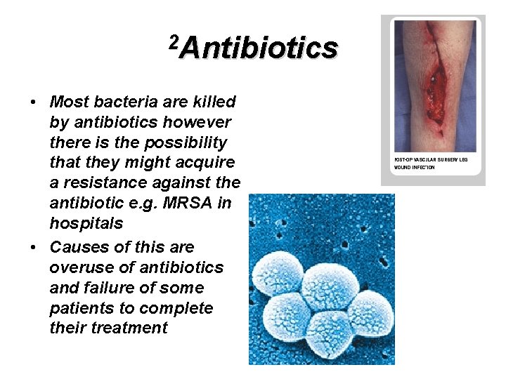 2 Antibiotics • Most bacteria are killed by antibiotics however there is the possibility
