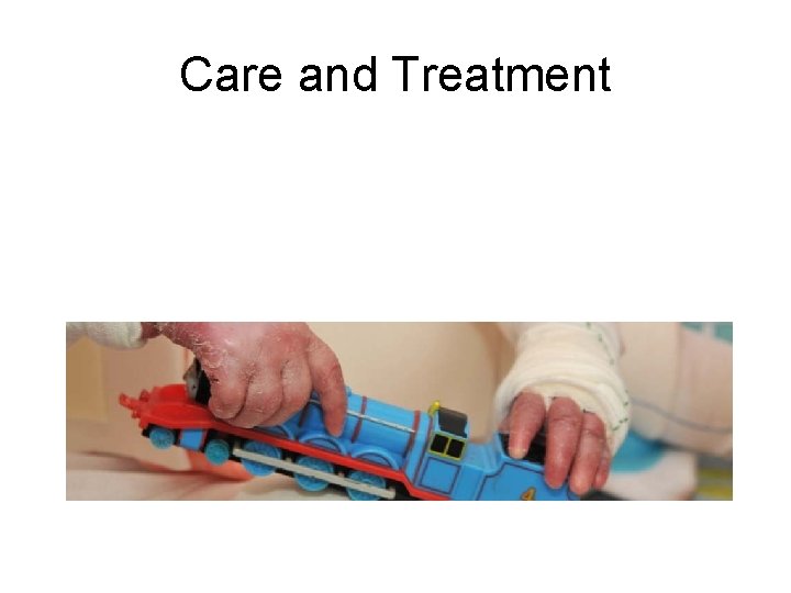 Care and Treatment 