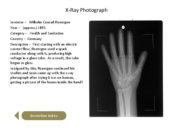 X-Ray Photograph Inventor – Wilhelm Conrad Roentgen Year – (approx. ) 1895 Category –