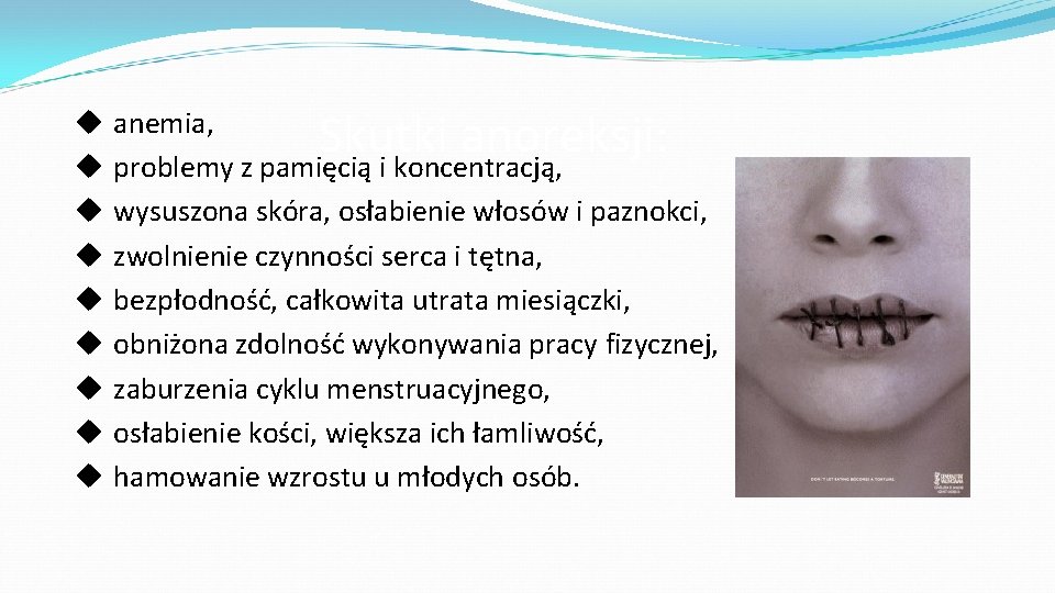  Skutki anoreksji: anemia, problemy z pamięcią i koncentracją, wysuszona skóra, osłabienie włosów i