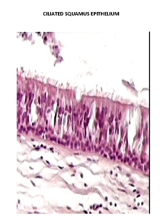 CILIATED SQUAMUS EPITHELIUM CILIATED SQUAMUS EPITHELIUM
