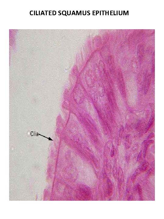 CILIATED SQUAMUS EPITHELIUM CILIATED SQUAMUS EPITHELIUM